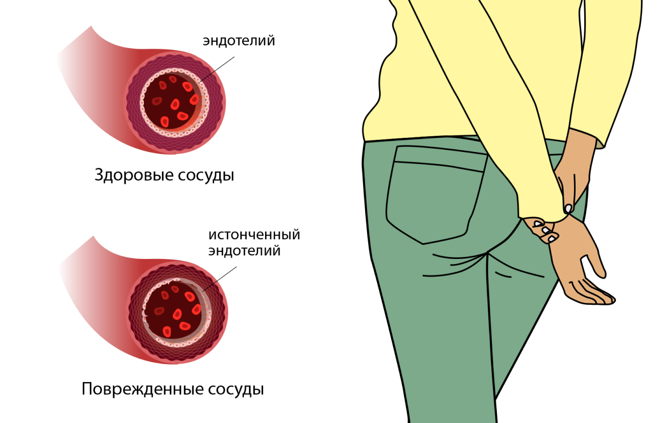 Типы сосудов